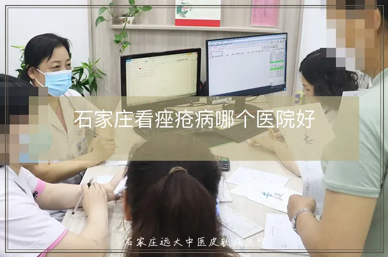 石家庄看痤疮病哪个医院好