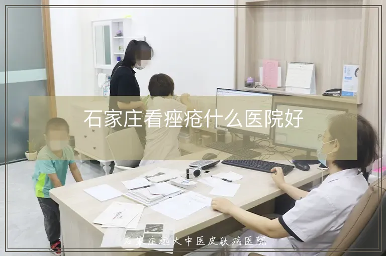 石家庄看痤疮什么医院好