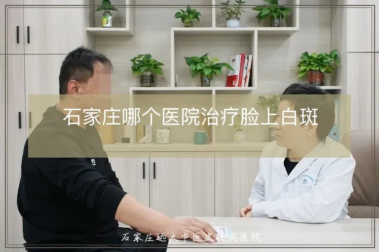 石家庄哪个医院治疗脸上白斑