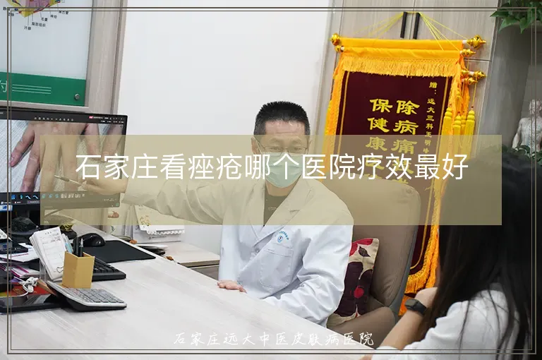 石家庄看痤疮哪个医院疗效最好