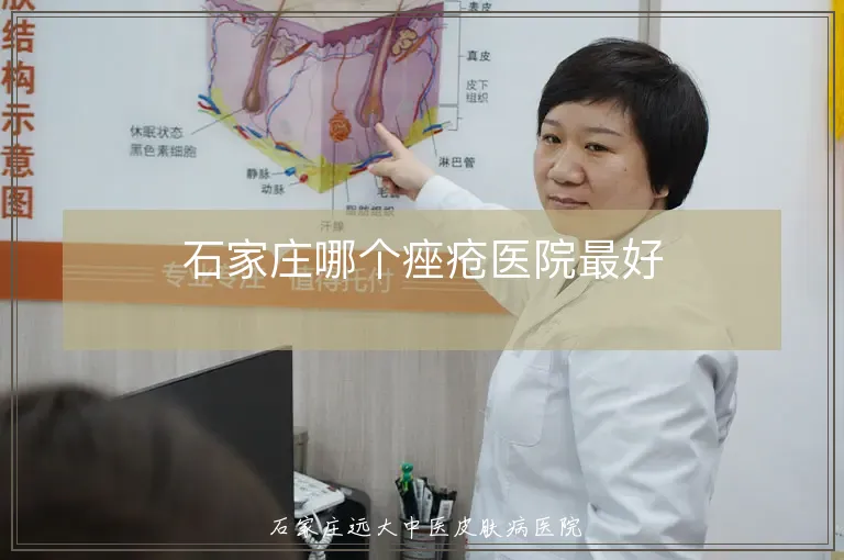 石家庄哪个痤疮医院最好