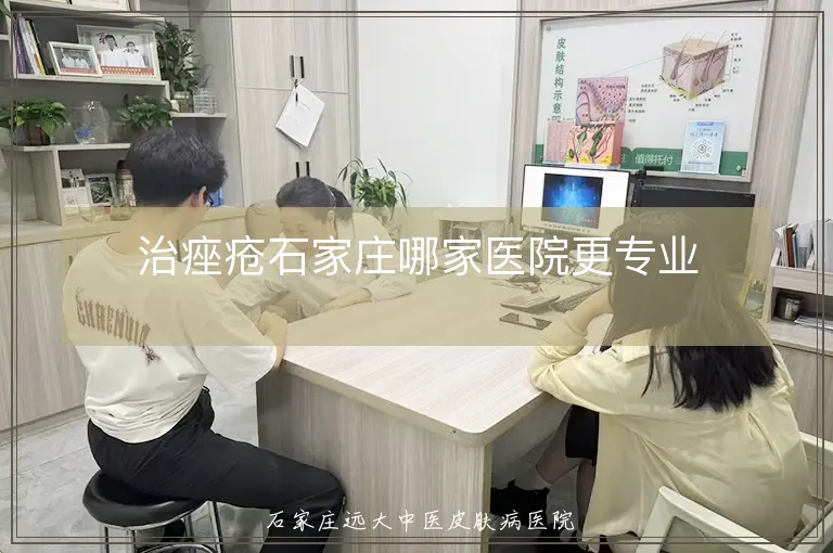 治痤疮石家庄哪家医院更专业