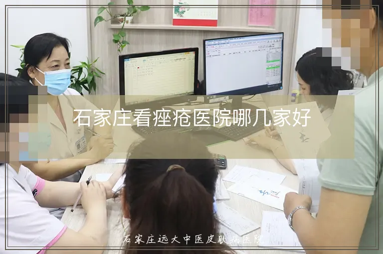石家庄看痤疮医院哪几家好
