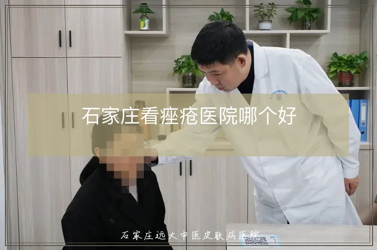 石家庄看痤疮医院哪个好