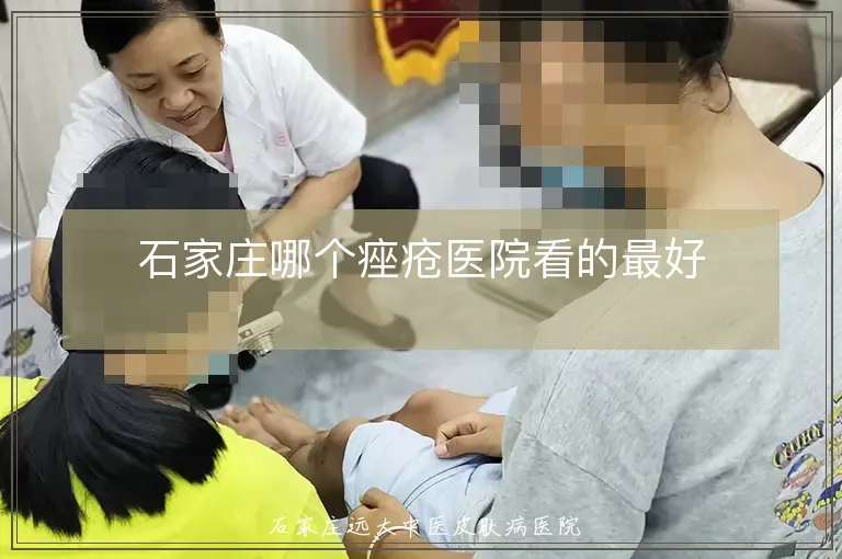 石家庄哪个痤疮医院看的最好