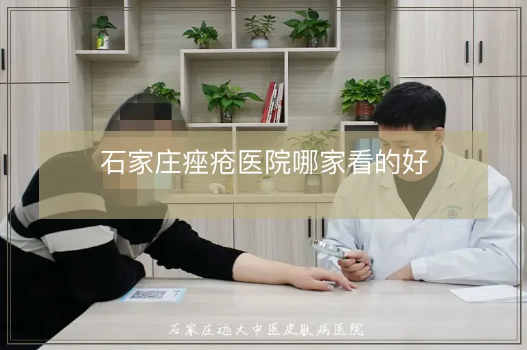 石家庄痤疮医院哪家看的好
