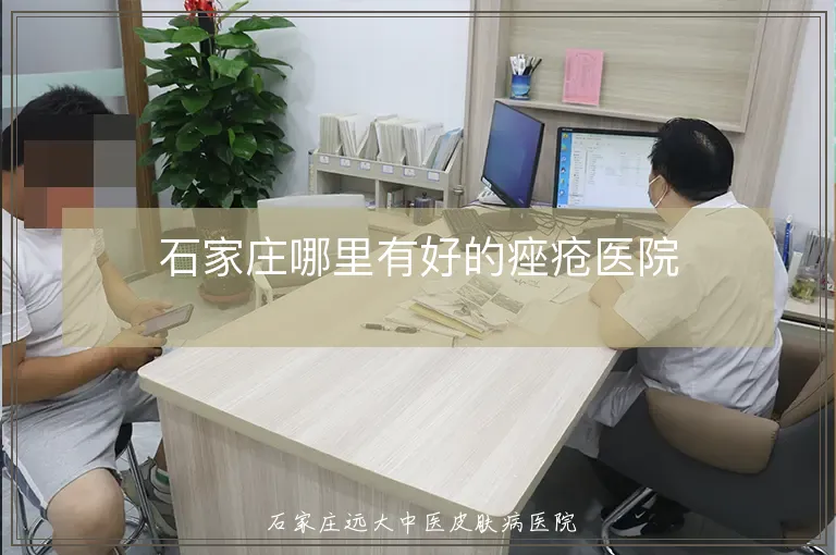 石家庄哪里有好的痤疮医院