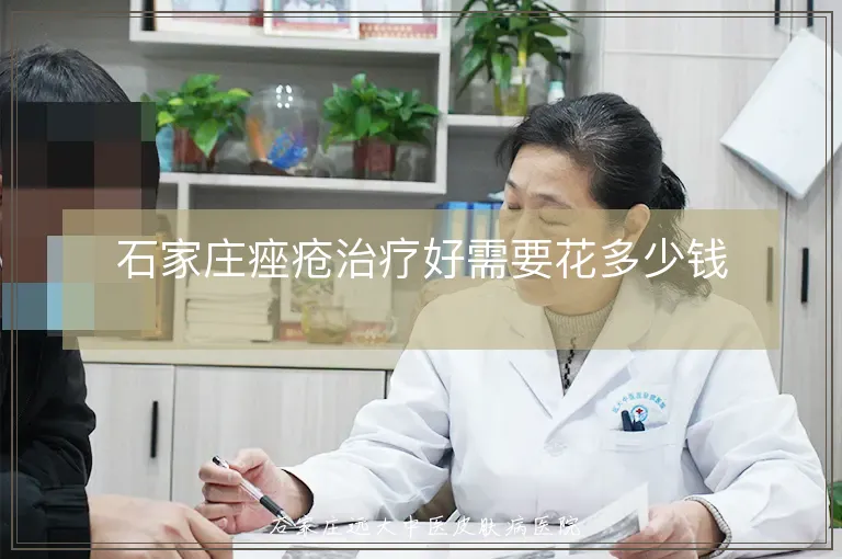 石家庄痤疮治疗好需要花多少钱