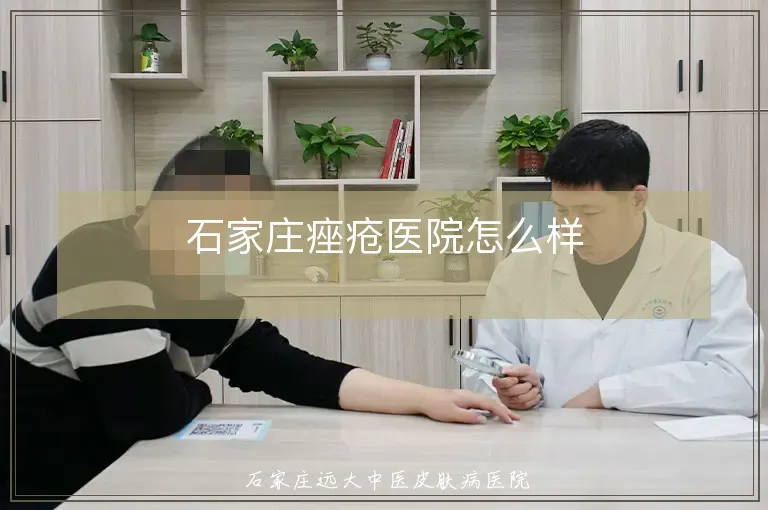 石家庄痤疮医院怎么样