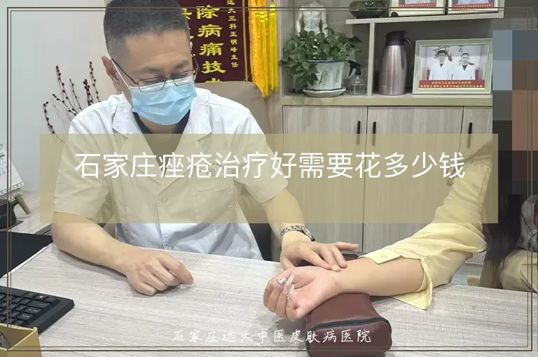 石家庄痤疮治疗好需要花多少钱