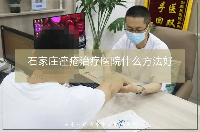 石家庄痤疮治疗医院什么方法好