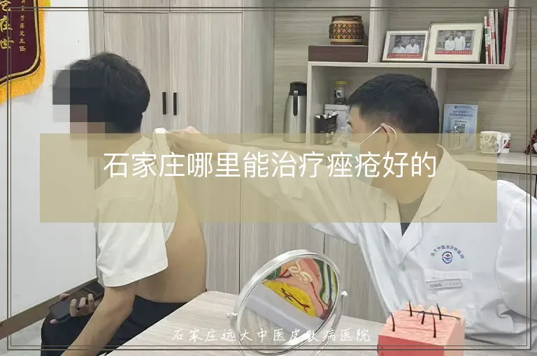 石家庄哪里能治疗痤疮好的