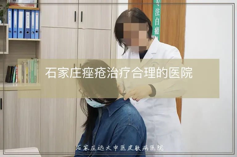 石家庄痤疮治疗合理的医院