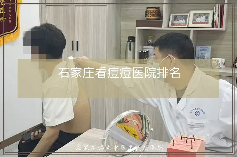 石家庄看痘痘医院排名