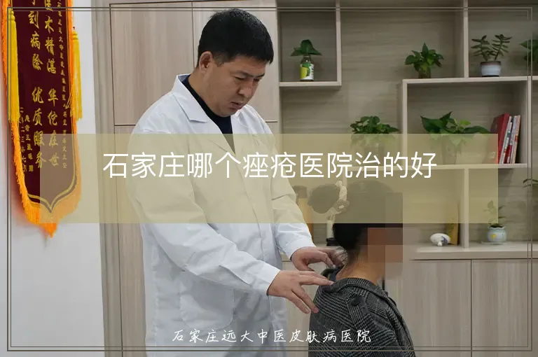 石家庄哪个痤疮医院治的好