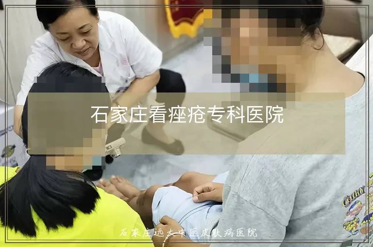 石家庄看痤疮专科医院