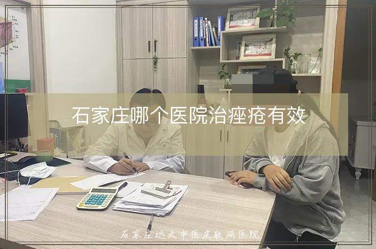 石家庄哪个医院治痤疮有效
