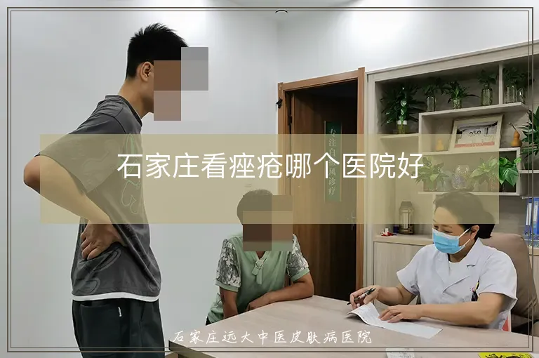 石家庄看痤疮哪个医院好