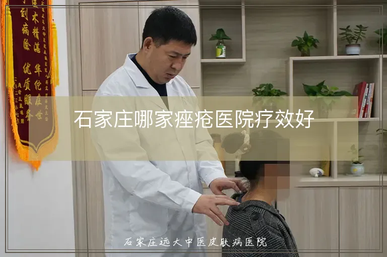 石家庄哪家痤疮医院疗效好