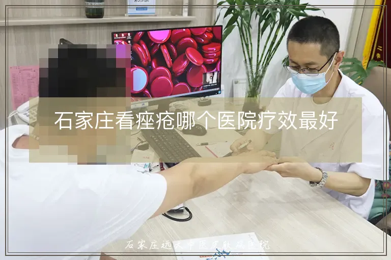石家庄看痤疮哪个医院疗效最好