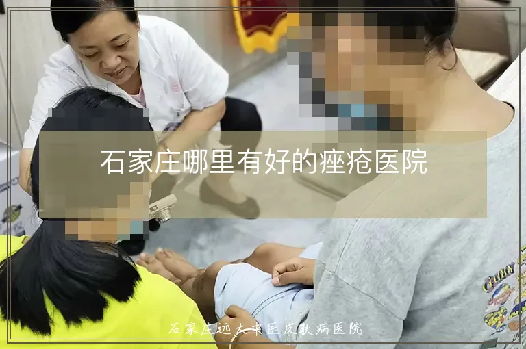 石家庄哪里有好的痤疮医院