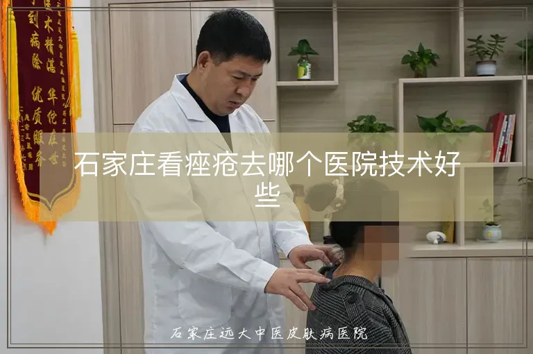 石家庄看痤疮去哪个医院技术好些