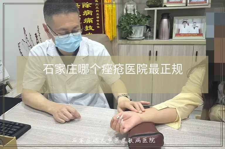 石家庄哪个痤疮医院最正规