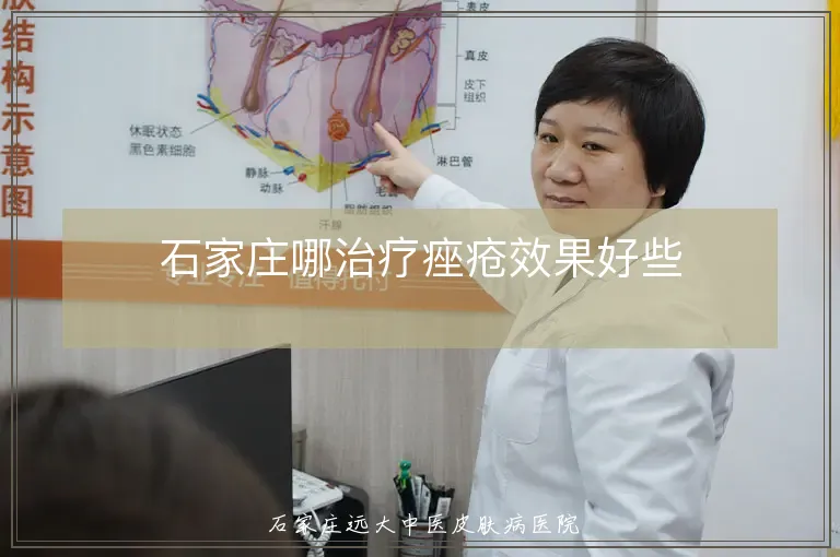 石家庄哪治疗痤疮效果好些