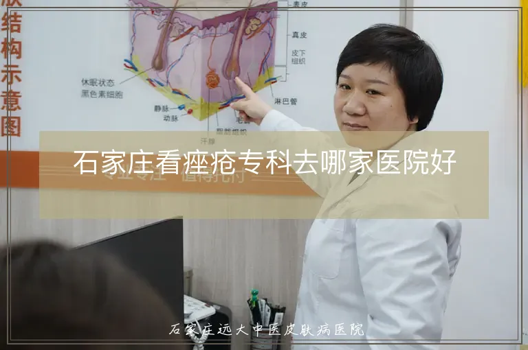 石家庄看痤疮专科去哪家医院好