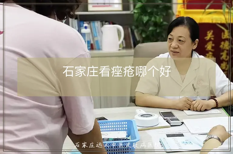 石家庄看痤疮哪个好