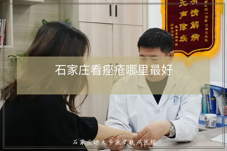 石家庄看痤疮哪里最好