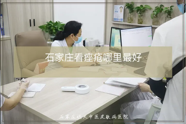 石家庄看痤疮哪里最好