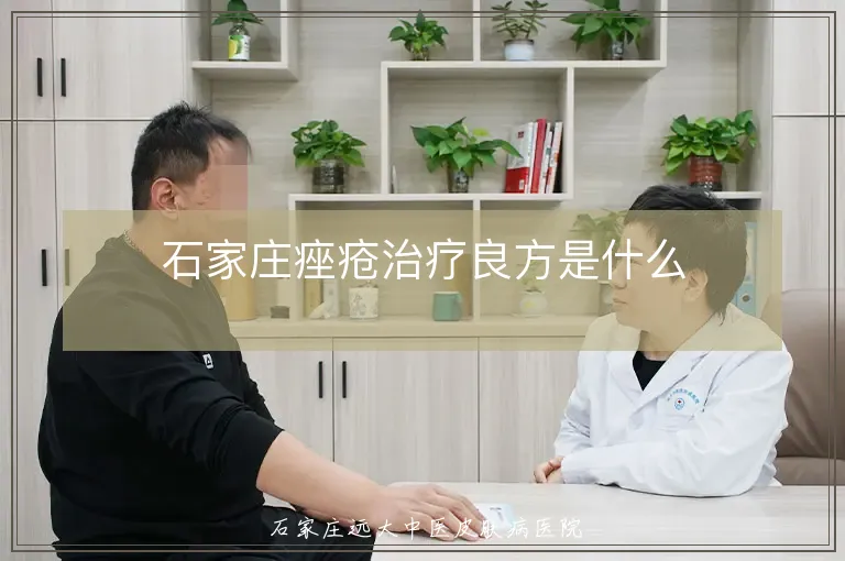 石家庄痤疮治疗良方是什么