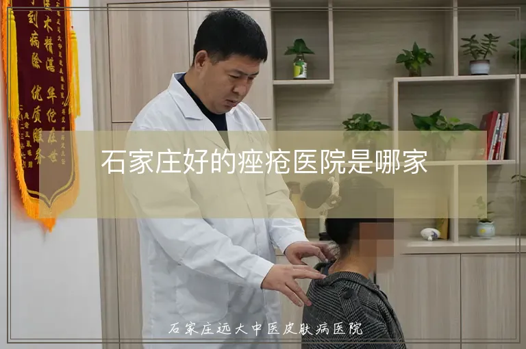 石家庄好的痤疮医院是哪家
