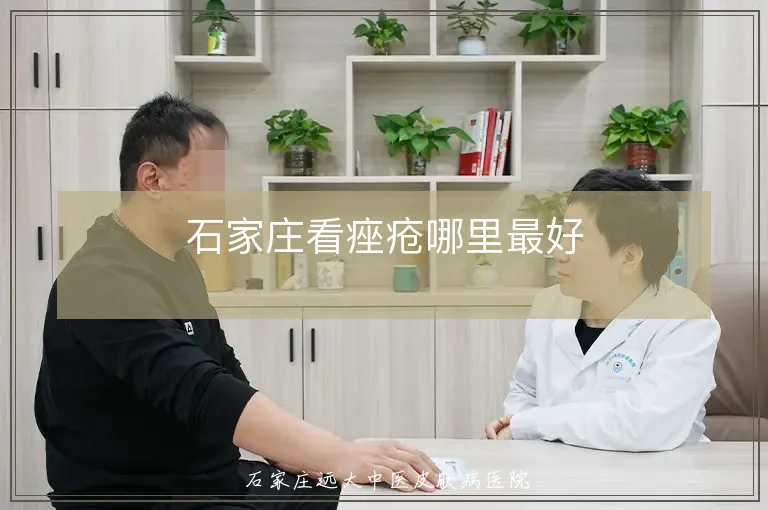 石家庄看痤疮哪里最好
