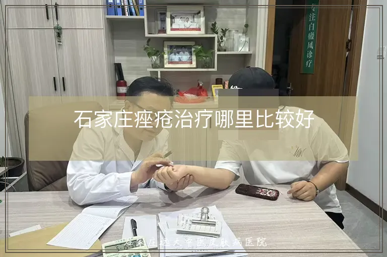 石家庄痤疮治疗哪里比较好