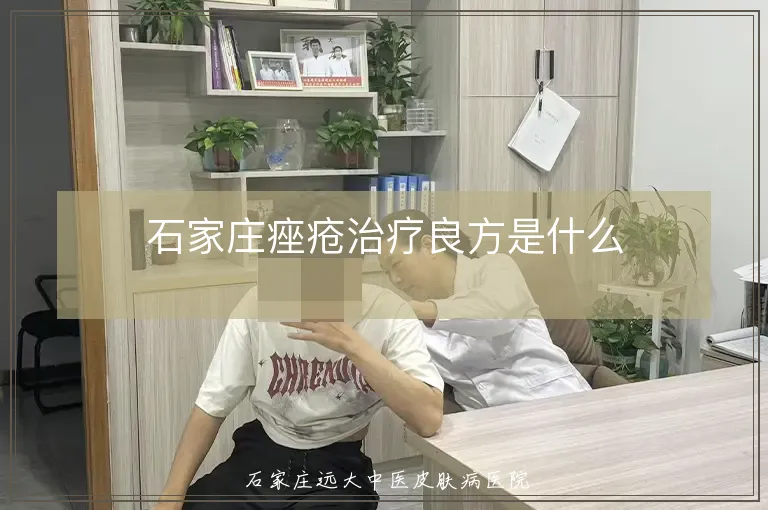 石家庄痤疮治疗良方是什么