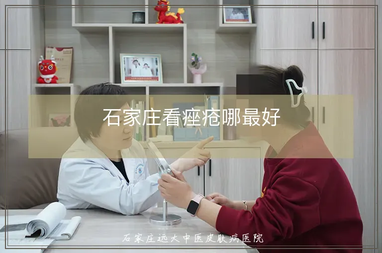 石家庄看痤疮哪最好