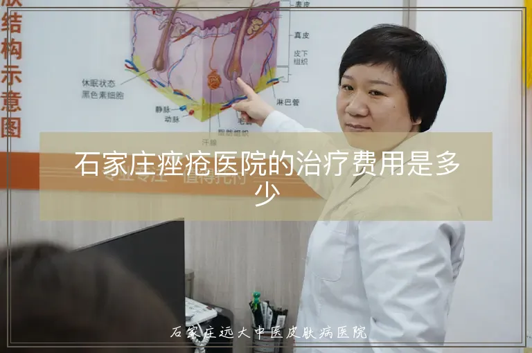 石家庄痤疮医院的治疗费用是多少