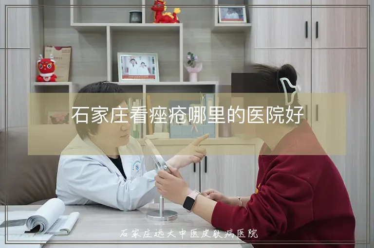石家庄看痤疮哪里的医院好