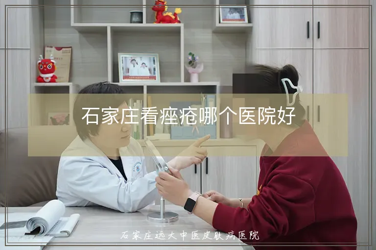 石家庄看痤疮哪个医院好
