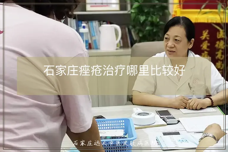 石家庄痤疮治疗哪里比较好