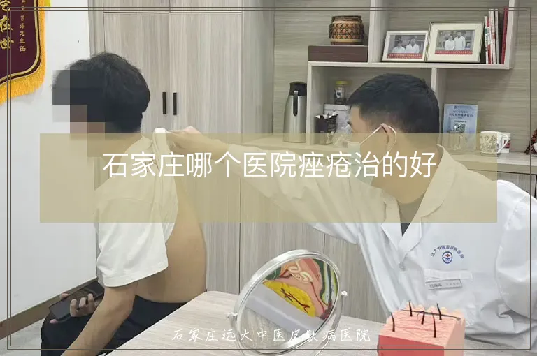 石家庄哪个医院痤疮治的好