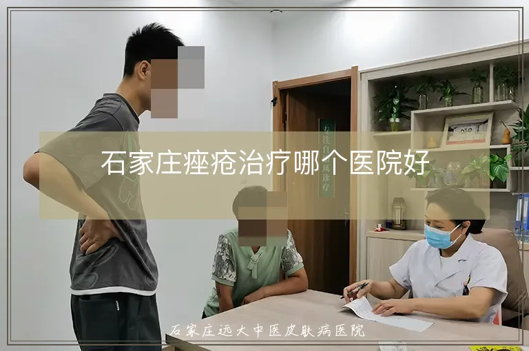 石家庄痤疮治疗哪个医院好