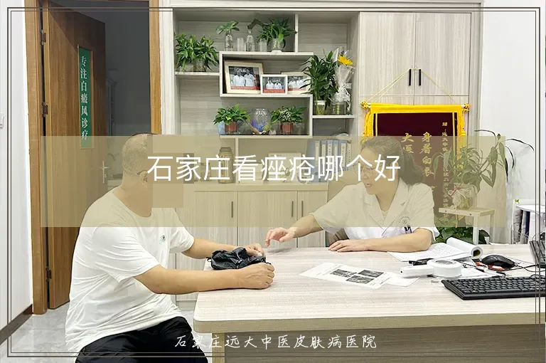 石家庄看痤疮哪个好