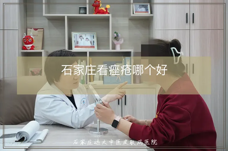 石家庄看痤疮哪个好