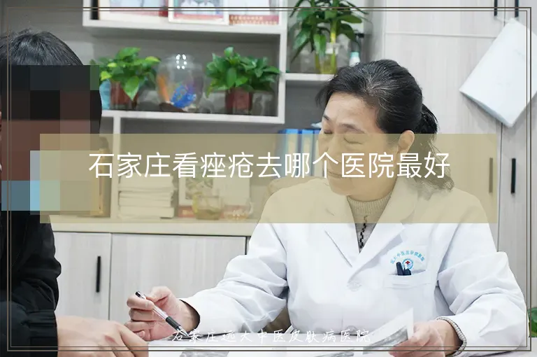 石家庄看痤疮去哪个医院最好