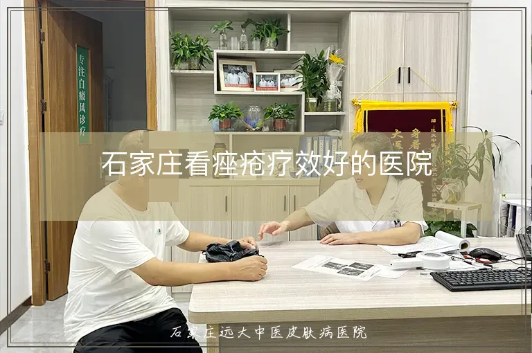 石家庄看痤疮疗效好的医院