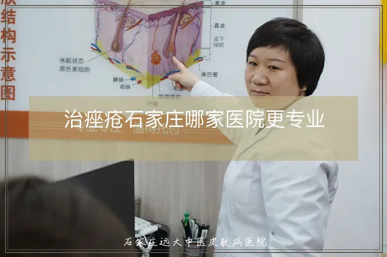 治痤疮石家庄哪家医院更专业