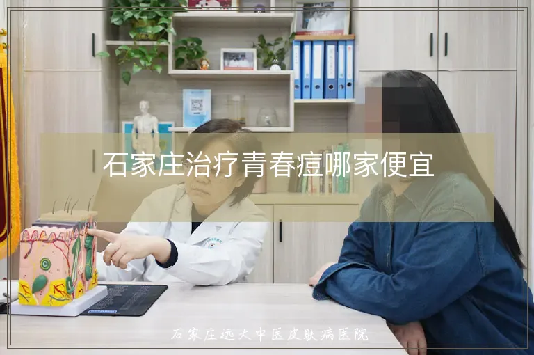 石家庄治疗青春痘哪家便宜